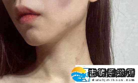 红雅典娜liya死了吗